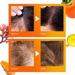 OMG! 3 in 1 Self HAIR CLINIC for Hair Restore - DOUBLE DARE